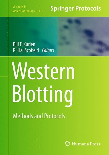 Western Blotting: Methods and Protocols