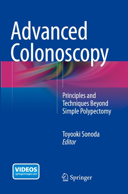 Advanced Colonoscopy: Principles and Techniques Beyond Simple Polypectomy
