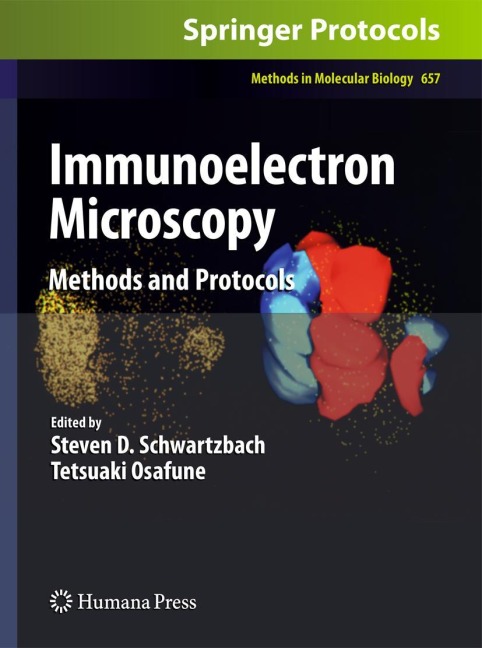 Immunoelectron Microscopy: Methods and Protocols