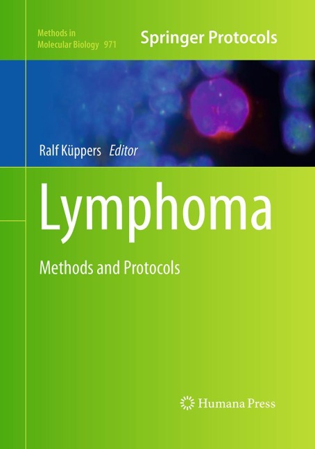 Lymphoma: Methods and Protocols
