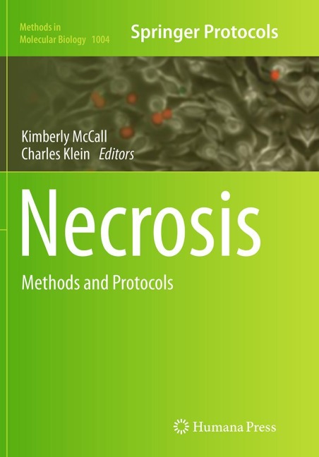 Necrosis: Methods and Protocols