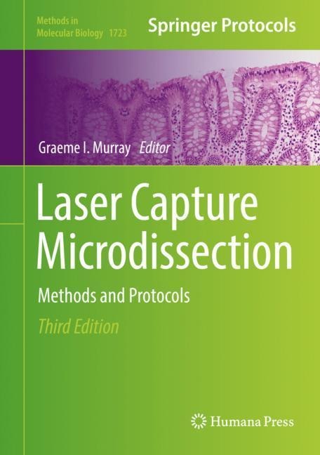 Laser Capture Microdissection: Methods and Protocols