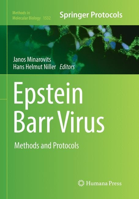 Epstein Barr Virus: Methods and Protocols