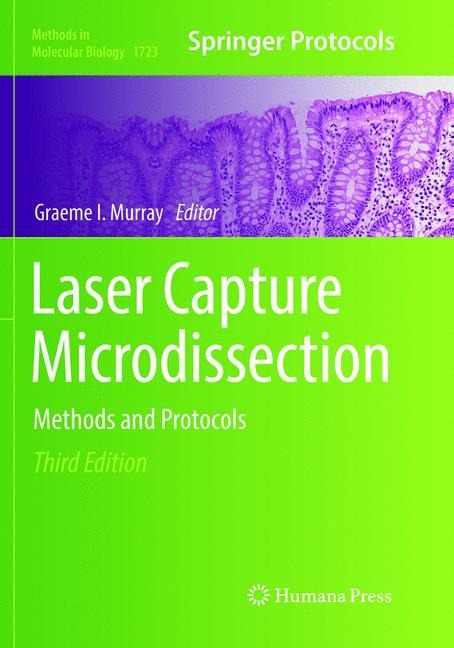 Laser Capture Microdissection: Methods and Protocols