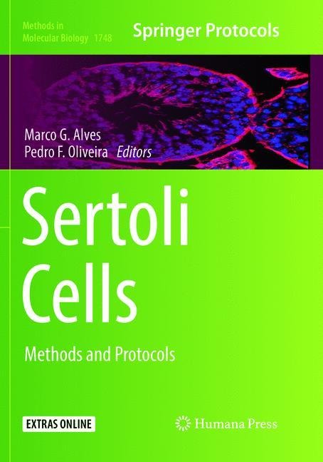 Sertoli Cells: Methods and Protocols