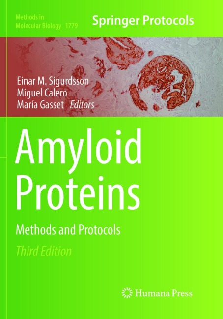 Amyloid Proteins: Methods and Protocols