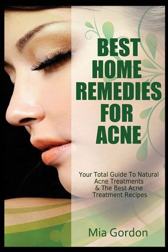 Best Home Remedies for Acne Your Total Guide to Natural Acne Treatments and the Best Acne Treatment Recipes