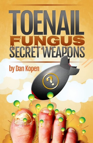 Toenail Fungus Secret Weapons Uncover Over 14 Toenail Fungus Treatments That You Can Combine to Clear Your Toe Nails in Under 45 Days!