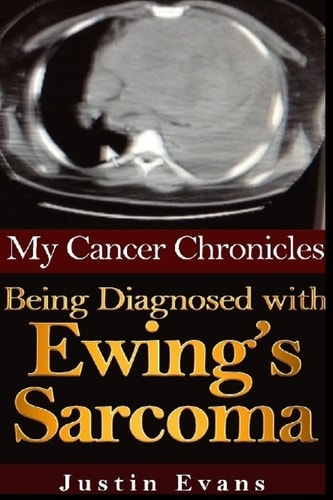 My Cancer Chronicles Being Diagnosed with Ewing's Sarcoma
