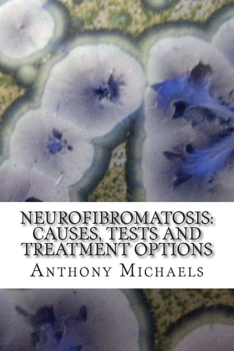 Neurofibromatosis Causes, Tests and Treatment Options