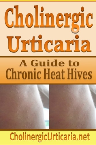 Cholinergic Urticaria A Guide to Chronic Heat Hives