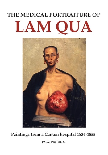 The Medical Portraiture of Lam Qua Paintings from a Canton Hospital 1836-1855