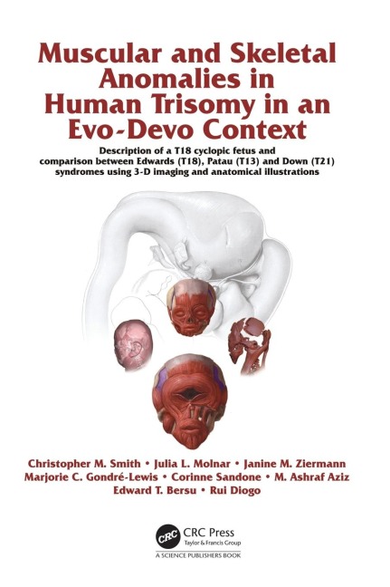 Muscular and Skeletal Anomalies in Human Trisomy in an Evo-Devo Context: Description of a T18 Cyclopic Fetus and Comparison Between Edwards (T18), Patau (T13) and Down (T21) Syndromes Using 3-D Imaging and Anatomical Illustrations