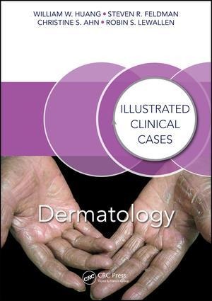 Dermatology: Illustrated Clinical Cases
