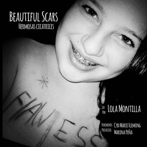 Beautiful Scars - Hermosas Cicatrices