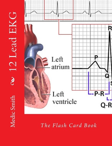 12 Lead EKG The Flash Card Book