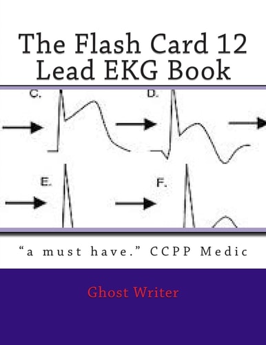 The Flash Card 12 Lead EKG