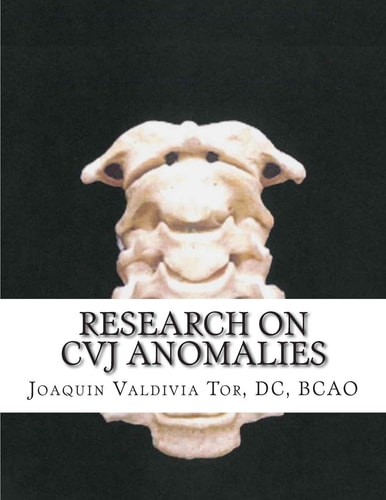 Research on CVJ Anomalies