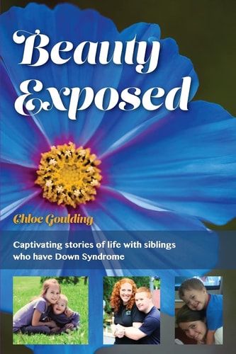 Beauty Exposed Captivating Stories of Life with Siblings who Have Down Syndrome