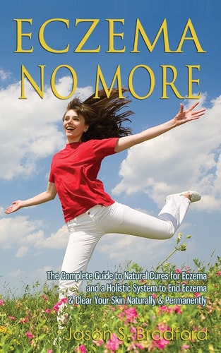 Eczema No More The Complete Guide to Natural Cures for Eczema and a Holistic System to End Eczema & Clear Your Skin Naturally & Permanently