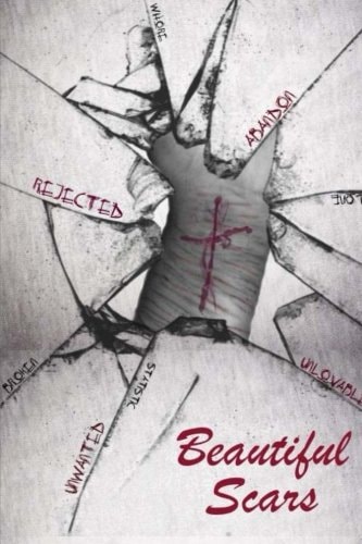 Beautiful Scars Beautiful Scars: a New Identity Comes in Healing