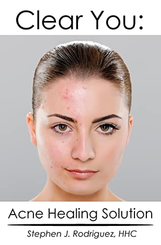 Clear You Acne Healing Solution