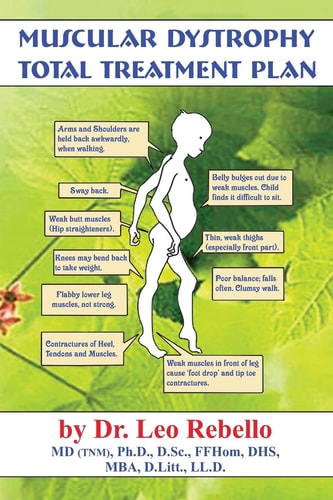 Muscular Dystrophy Total Treatment Plan