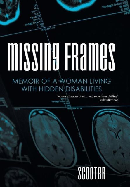 Missing Frames: Memoir of a Woman Living with Hidden Disabilities