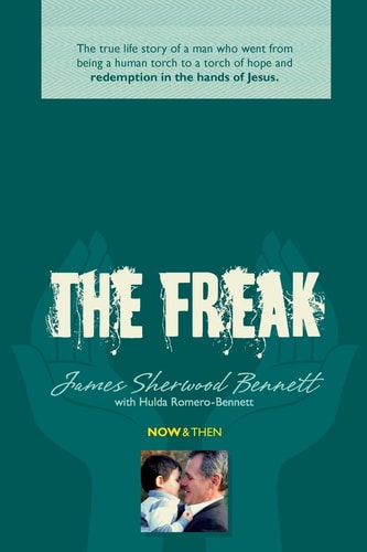 The Freak The True Life Story of a Man Who Went from Being a Human Torch to a Torch of Hope and Redemption in the Hands of Jesus