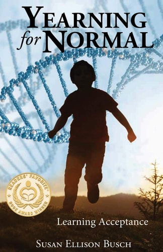 Yearning for Normal Learning Acceptance