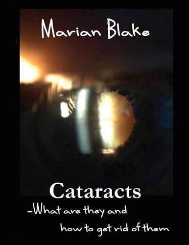 Cataracts What Are They and How to Get Rid of Them?