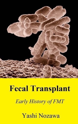 Fecal Transplant Early History of FMT