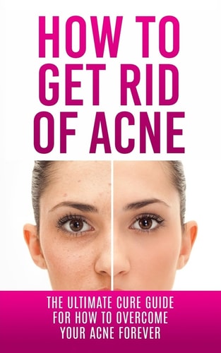 How to Get Rid of Acne The Ultimate Cure Guide for How to Overcome Your Acne Forever