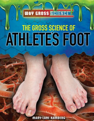 The Gross Science of Athlete’s Foot