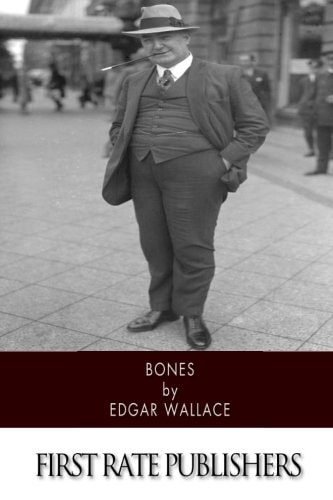 Bones