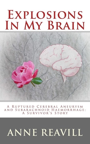 Explosions in My Brain A Ruptures Cerebral Aneurysm and Subarachnoid Haemorrhage; a Surviver's Story