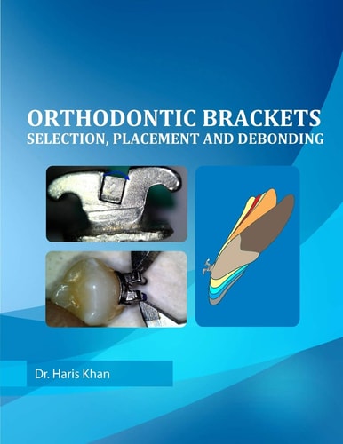 Orthodontic Brackets Selection, Placement and Debonding