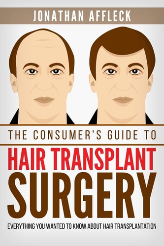 The Consumer's Guide to Hair Transplant Surgery Everything You Wanted to Know About Hair Transplantation