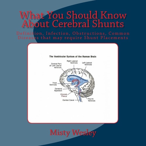 What You Should Know About Cerebral Shunts Definition, Infection, Obstructions, Common Diseases that May Require Shunt Placements