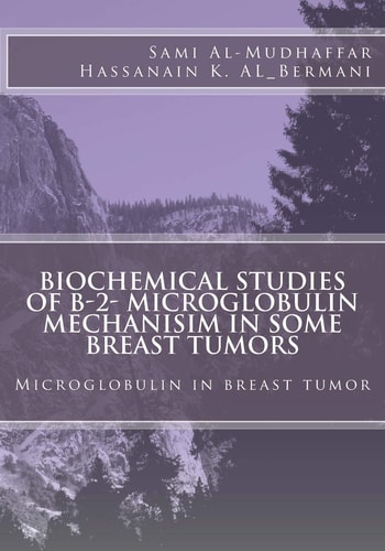 Biochemical Studies of B-2- Microglobulin Mechanisim in Some Breast Tumors Microglobulin in Breast Tumor