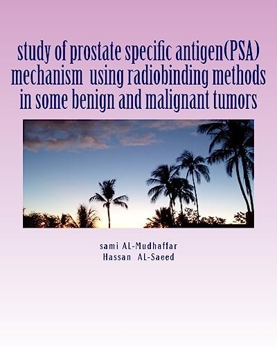 Study of Prostate Specific Antigen(PSA) Mechanism Using Radiobinding Methods in Some Benign and Malignant Tumors PSA in Tumors