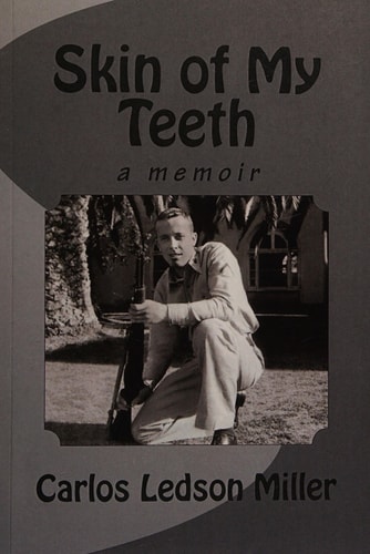 Skin of My Teeth A Memoir