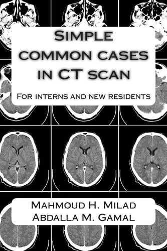 Simple Common Cases in CT Scan For Interns and New Residents