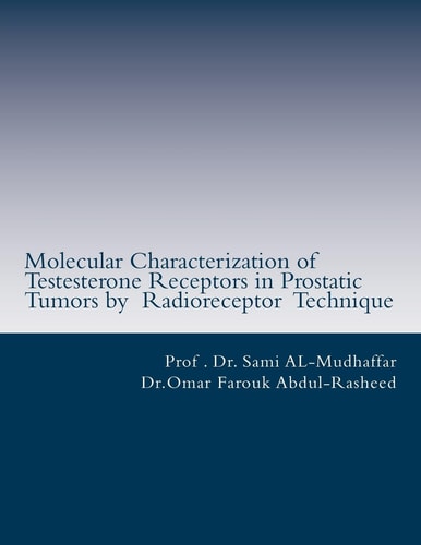 Molecular Characterization of Testerone Receptors in Prostatic Tumors by Radioreceptor Technique Testeserone and Prostate