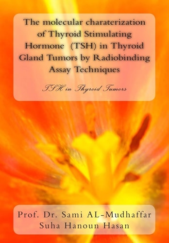 The Molecular Charaterization of Thyroid Stimulating Hormone (TSH) in Thyroid Gland Tumors by Radiobinding Assay Techniques TSH in Thyroid Tumors