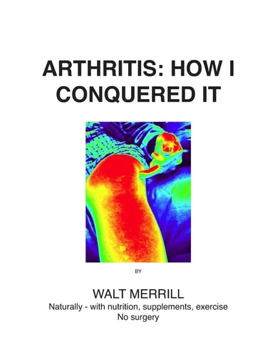 Arthritis: How I Conquered It! Naturally: with Nutrition, Supplements, Exercise- Not Surgery