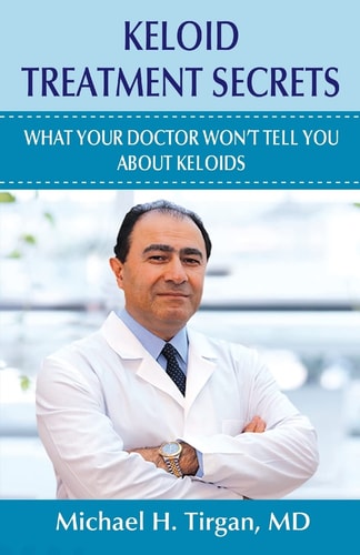 Keloid Treatment Secrets What Your Doctor Wont Tell You.