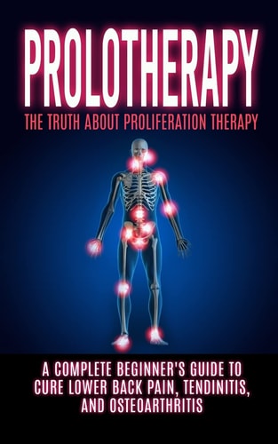 Prolotherapy The Truth About Proliferation Therapy: A Complete Beginner's Guide to Cure Lower Back Pain, Tendinitis, And Osteoarthritis
