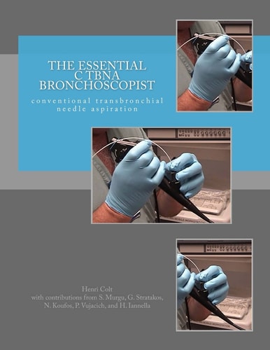 The Essential CTBNA Bronchoscopist Conventional TransBronchial Needle Aspiration