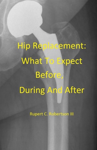 Hip Replacement What To Expect Before, During and After